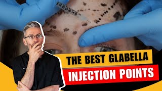 Injecting the glabella Injection Points amp Safety Advice [upl. by Nonnag]