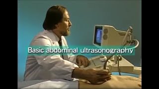 How to do abdominal ultrasound examination [upl. by Znerol351]