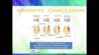 PERIODONTITIS STAGING amp GRADING [upl. by Tremain]