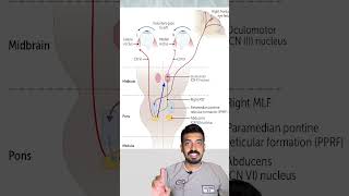 Internuclear Ophthalmoplegia concept explained in 3minutes [upl. by Nalani]