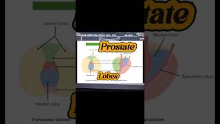 Prostate Ultrasound  Enlarged Prostate  BPH  Median Lobe Prostate  Prostatomegaly on Usg [upl. by Wolfie]