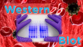 Cómo hacer un Western Blot [upl. by Jabin]