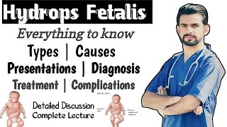 Hydrops Fetalis  causes types management complications [upl. by Uchish]