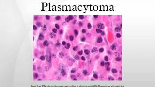 Plasmacytoma [upl. by Podvin]