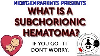 What’s a subchorionic hematoma [upl. by Eleph]