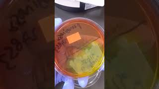 Burkholderia cepacia B cepacia  Microbiology [upl. by Nap122]