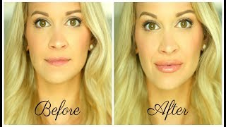 How To Get BIGGER Lips Without Injections 💋 Juvalips Review [upl. by Carlita876]