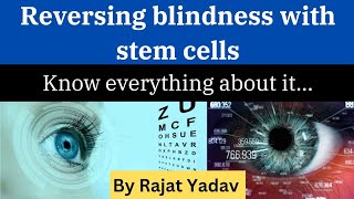 What is stem cell therapy for under eyes Can stem cells cure blindness [upl. by Allehs365]