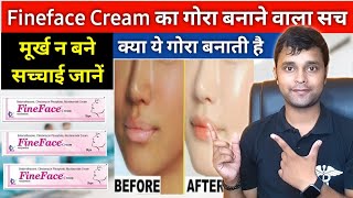 गोरा करने वाली क्रीम  Fineface cream review  Best cream for Acne treatment  Fineface cream Review [upl. by Caras]