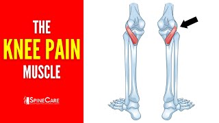 The Knee Pain Muscle How to Release It for INSTANT RELIEF [upl. by Verger241]