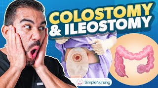 Colostomy and Ileostomy Nursing  Indications Complications Care EASY [upl. by Saalocin]