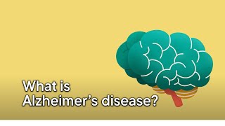 What is Alzheimers disease [upl. by Franci121]