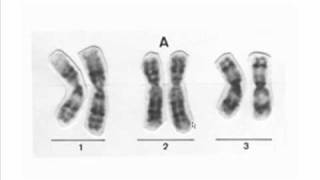 diferencias entre cromosomas [upl. by Stevie]
