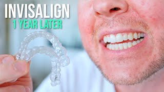 10 Things I Wish I Knew BEFORE Getting Invisalign [upl. by Vivyanne]