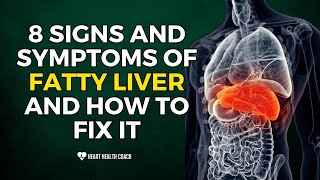 8 Signs and Symptoms of Fatty Liver and How to Fix It [upl. by Hamlen]