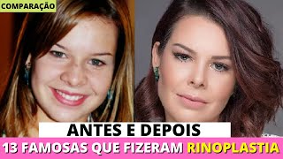 Antes e Depois de 13 FAMOSAS BRASILEIRAS que Fizeram RINOPLASTIA  Comparações amp Curiosidades [upl. by Riehl291]