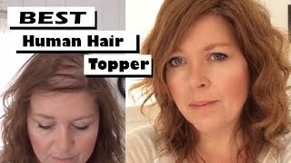 Best human hair toppers amp hairpieces for fine thinning hair amp ALOPECIA  One womans touching story [upl. by Xymenes77]