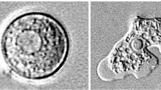 How to stay safe from the braineating amoeba [upl. by Yrrap]