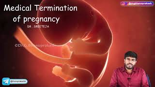 Medical Termination Of Pregnancy  Obstetrics and Gynaecology Lecture [upl. by Amleht]