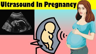 Ultrasound Scan In Pregnancy Obstetric Ultrasonography Pregnancy Ultrasound Scan [upl. by Remat792]