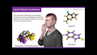 INBORN ERRORS OF NUCLEIC ACID METABOLISM  LESCH–NYHAN SYNDROME [upl. by Rydder]