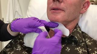 Kybella Injections by an Allergan Nurse Educator  Skin365 [upl. by Gaston]