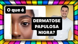 DERMATOSE PAPULOSA NIGRA O que é [upl. by Ashien]