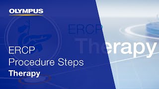 ERCP Procedure Steps I Therapy [upl. by Claresta]