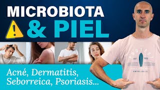 MICROBIOTA ⚠️ PROBLEMAS de la PIEL y DISBIOSIS intestinal [upl. by Alphonsine]