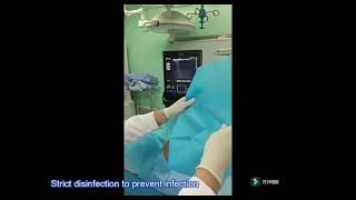 Ultrasoundguided approach for puncturing dorsal root ganglion – Video abstract 479986 [upl. by Nuhsyar]