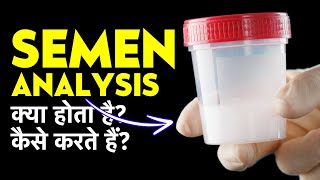 Semen Analysis Test Procedure amp Report in Hindi  Semen Analysis Kaise Hota Hai [upl. by Hairabez]