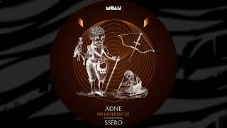 Adne  Im Different Ssero RemixMOAN208 [upl. by Ahsieki338]