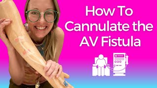 Dialysis Nursing How to Cannulate the AV FISTULA [upl. by Imalda]