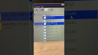 For MRI Techs How to perform manual subtractions on MRI scanner [upl. by Attennek598]