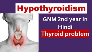 Hypothyroidism gnm 2nd year  in hindi  cause symptoms treatment  thyroid problem [upl. by Asikal]