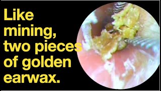 Like mining two pieces of golden earwaxear wax removal  ear cleaning  ASMR  relaxation  relax [upl. by Bakerman790]