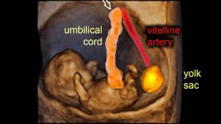 9 weeks of pregnancy gestational sac and embryo  3D scan [upl. by Yarezed]