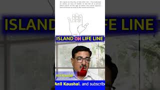 ISLAND ON LIFE LINE anilkaushal58 astrologer palmistry handline hastrekha palmist jyotish [upl. by Annnora]