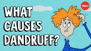 What causes dandruff and how do you get rid of it  Thomas L Dawson [upl. by Walcott]