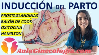 INDUCCIÓN DEL PARTO 💊 PROSTAGLANDINAS ⚽ BALÓN DE COOK OXITOCINA  Ginecología y Obstetricia [upl. by Wengert]