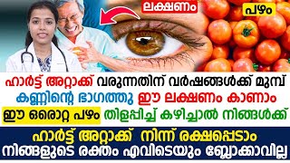 കണ്ണിന്റെ ഭാഗത്ത് ഈ ലക്ഷണങ്ങൾ കാണുന്നുണ്ടോ ഈ പഴം തിളപ്പിച്ച് കഴിച്ചാൽ ഹാർട്ട് അറ്റാക്ക് വരില്ല [upl. by Cony]