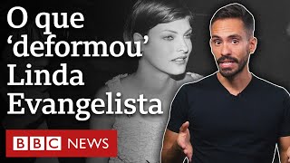 Criolipólise o procedimento estético que deformou modelo Linda Evangelista [upl. by Narmak922]