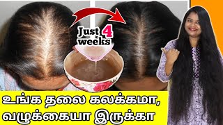 🔥JUST 4 WEEKS போதும்😱 வழுக்கையா தெரியுற உங்க தலையில் நெருக்கமா முடி முளைக்கும்  baldness tips [upl. by Yehsa]