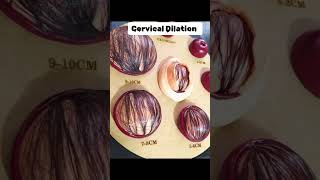 Cervical Dilation cervix cervical pregnant midwife [upl. by Ainad]