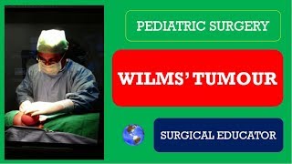 WILMS TUMOUR  How To DIAGNOSE amp TREAT Pediatric Surgery [upl. by Glendon]