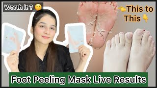 Foot exfoliating and peeling mask  best foot care  crack heel solution  crazy foot peeling 😍 [upl. by Arjan169]