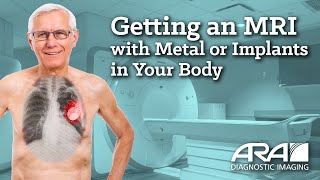 Getting an MRI with Metal or Implants in Your Body  ARA Diagnostic Imaging [upl. by Gregory]