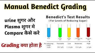 Benedict test grading [upl. by Aronow933]