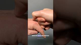 The Truth Behind Finger Cracking Sounds science sciencefacts [upl. by Coleen]