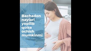 Bachadon naylari yopilib qolsa ochish mumkinmi  bepushtlik eko eco homiladorlik davolash [upl. by Magen]